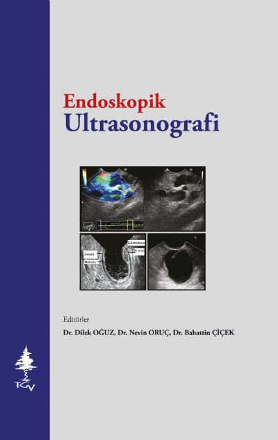 Endoskopik Ultrasonografi (Sınırlı Sayıda)