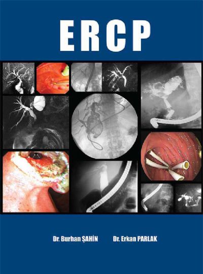 ERCP