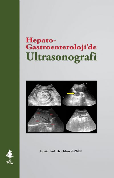 Hepato-Gastroenterolojide Ultrasonografi (Sınırlı Sayıda)